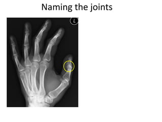 Naming the joints
 