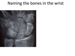 Naming the bones in the wrist
 