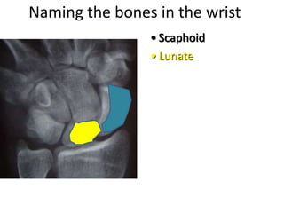 Naming the bones in the wrist
• Scaphoid
• Lunate
 