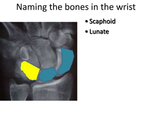 Naming the bones in the wrist
• Scaphoid
• Lunate
 