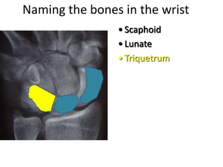 Naming the bones in the wrist
• Scaphoid
• Lunate
• Triquetrum
 