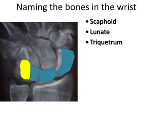 Naming the bones in the wrist
• Scaphoid
• Lunate
• Triquetrum
 