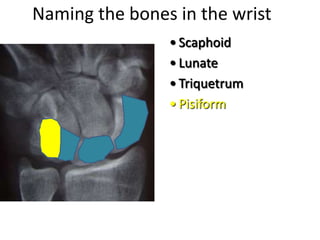 Naming the bones in the wrist
• Scaphoid
• Lunate
• Triquetrum
• Pisiform
 
