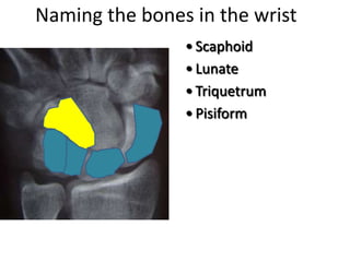 Naming the bones in the wrist
• Scaphoid
• Lunate
• Triquetrum
• Pisiform
 
