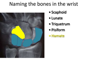 Naming the bones in the wrist
• Scaphoid
• Lunate
• Triquetrum
• Pisiform
• Hamate
 