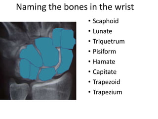 Naming the bones in the wrist
• Scaphoid
• Lunate
• Triquetrum
• Pisiform
• Hamate
• Capitate
• Trapezoid
• Trapezium
 