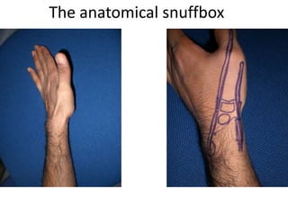 The anatomical snuffbox
 