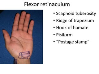 Flexor retinaculum
• Scaphoid tuberosity
• Ridge of trapezium
• Hook of hamate
• Pisiform
• “Postage stamp”
 