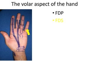 The volar aspect of the hand
• FDP
• FDS
 