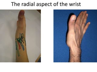 The radial aspect of the wrist
 