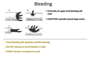 Bleeding
• Practically all upper limb bleeding will
stop!
• EXCEPTION: partially injured large artery
• Treat bleeding with elevation and firm dressing
• DO NOT attempt to tie off bleeders in A&E
• RARELY should a tourniquet be used
 