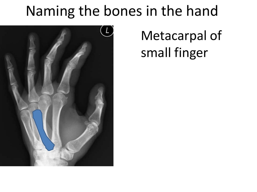 Hand surface anatomy