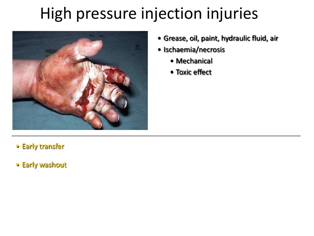 Hand surface anatomy