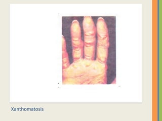 Xanthomatosis