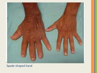 Spade shaped hand