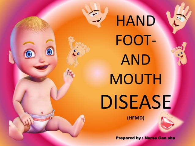 Hand foot & mouth disease | PPSX | Infectious Diseases | Diseases and