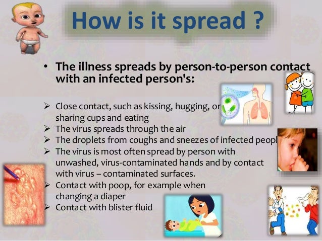 Hand Foot Mouth Disease