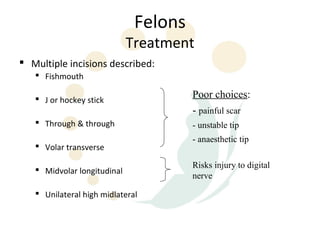 Felons
                             Treatment
 Multiple incisions described:
    Fishmouth

    J or hockey stick                 Poor choices:
                                       - painful scar
    Through & through                 - unstable tip
                                       - anaesthetic tip
    Volar transverse

                                       Risks injury to digital
    Midvolar longitudinal
                                       nerve

    Unilateral high midlateral
 