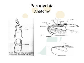 Paronychia
 Anatomy
 