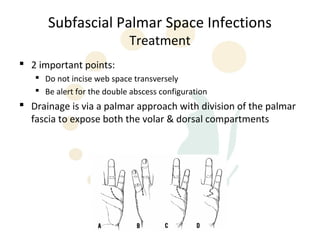 Subfascial Palmar Space Infections
                            Treatment
 2 important points:
    Do not incise web space transversely
    Be alert for the double abscess configuration
 Drainage is via a palmar approach with division of the palmar
  fascia to expose both the volar & dorsal compartments
 