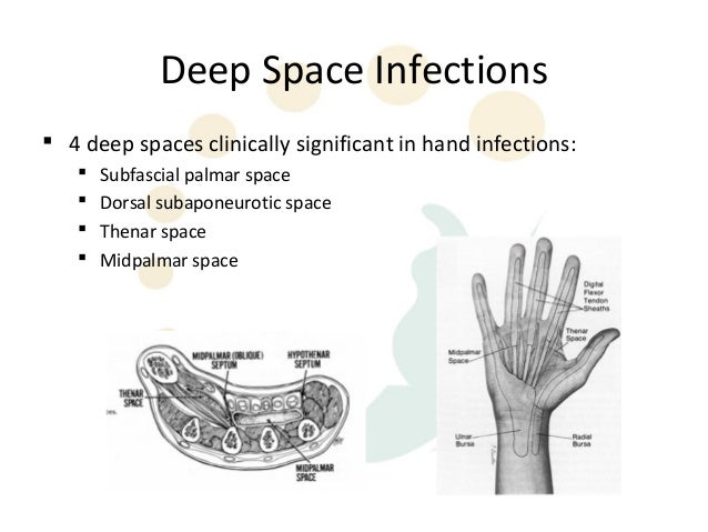 Fingernail and Fingertip Fungus Infections by Dr. David Nelson