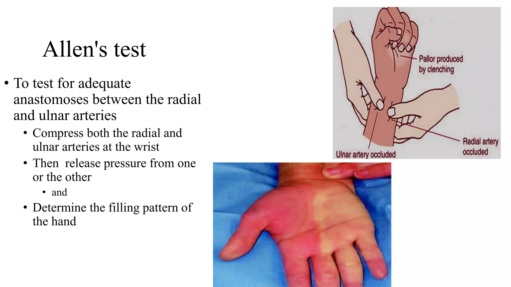 Hand-spaces and arterial arches.pptx