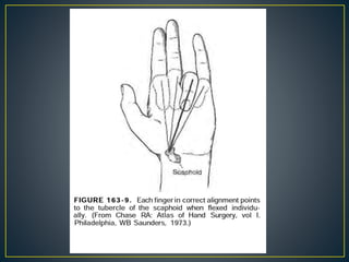 Sharpa Hand Structure Hand anatomy- harsh amin | PPTX