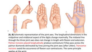 Hand anatomy 1 | PDF