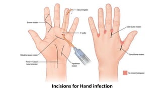 Hand anatomy 1 | PDF