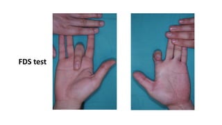 Hand anatomy 1 | PDF