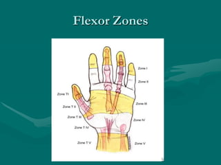 Flexor Zones
 