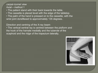 Tangential Hand View Radiography Hand and fore arm radiology truma girish gunar | PPTX