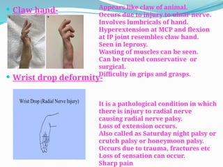 HAND assessment physiotherapy........... | PPTX