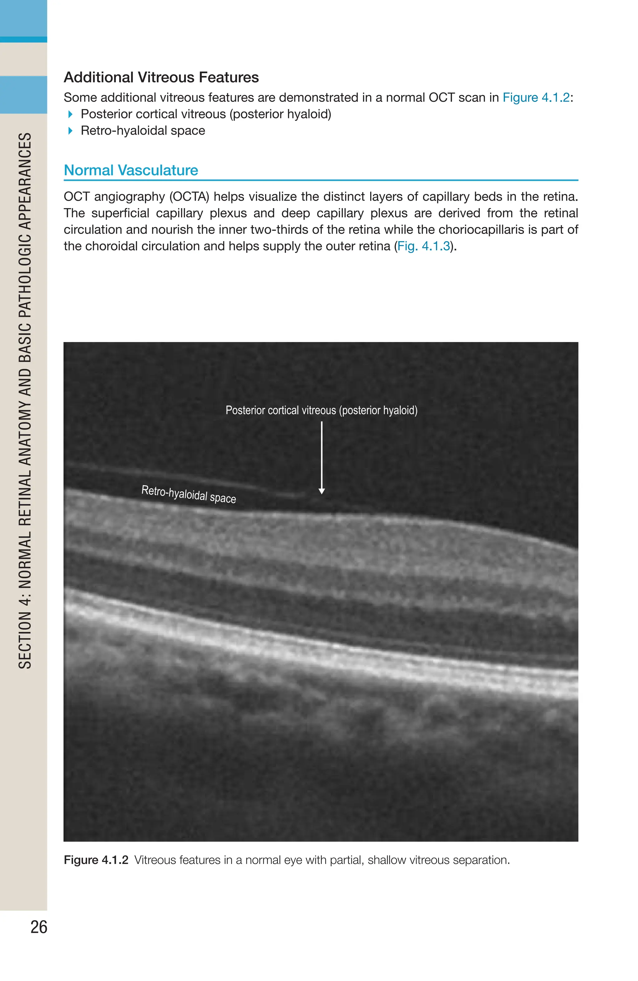 Handbook of Retinal OCT Second Edition.. | PDF