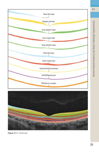Retina Layers Oct Worksheet.pdf Handbook of Retinal OCT Second Edition.. | PDF