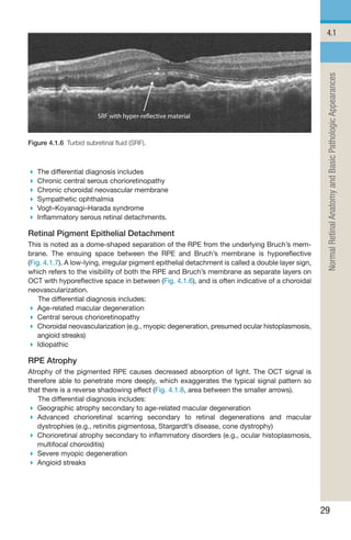 Handbook of Retinal OCT Second Edition.. | PDF