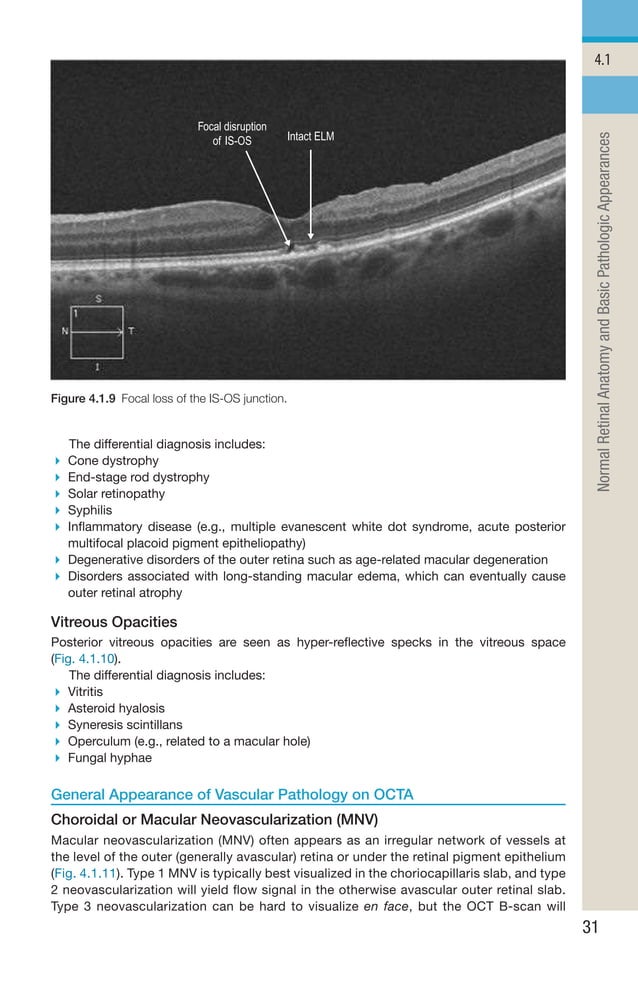 Handbook of Retinal OCT Second Edition.. | PDF