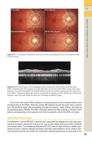 Handbook of Retinal OCT Second Edition.. | PDF