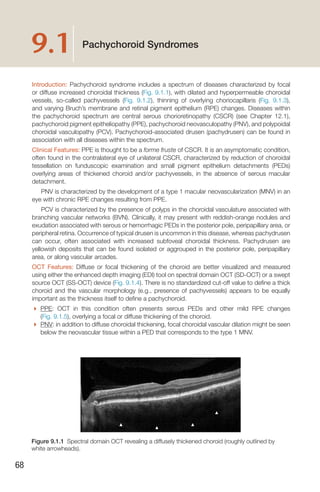 Handbook of Retinal OCT Second Edition.. | PDF