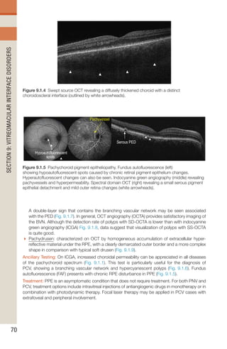Handbook of Retinal OCT Second Edition.. | PDF