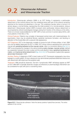 Handbook of Retinal OCT Second Edition.. | PDF
