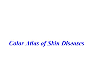 Color Atlas of Skin Diseases

 