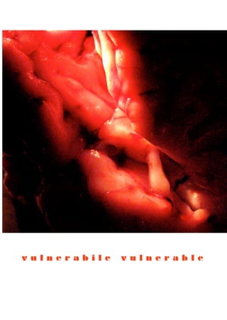 v u l n e r a b i l e   v u l n e r a b l e
 