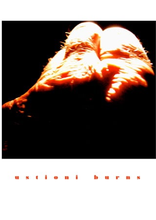 u   s   t   i   o   n   i   b   u   r   n   s
 