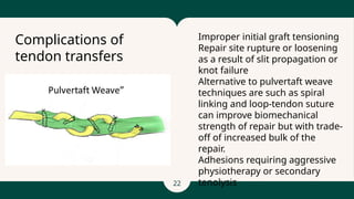 22
- Improper initial graft tensioning
- Repair site rupture or loosening
as a result of slit propagation or
knot failure
- Alternative to pulvertaft weave
techniques are such as spiral
linking and loop-tendon suture
can improve biomechanical
strength of repair but with trade-
off of increased bulk of the
repair.
- Adhesions requiring aggressive
physiotherapy or secondary
tenolysis
Complications of
tendon transfers
 