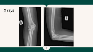 6
X rays
 
