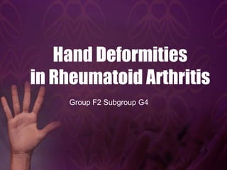 Hand Deformities
in Rheumatoid Arthritis
Group F2 Subgroup G4

 