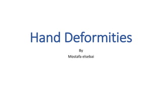 Hand Deformities
By
Mostafa elsebai
 