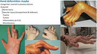 Hand deformities upload | PDF