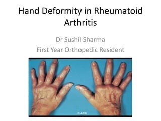 Hand Deformity in Rheumatoid 
Arthritis 
Dr Sushil Sharma 
First Year Orthopedic Resident 
 